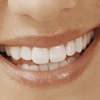 Clareamento dental: sorriso branco